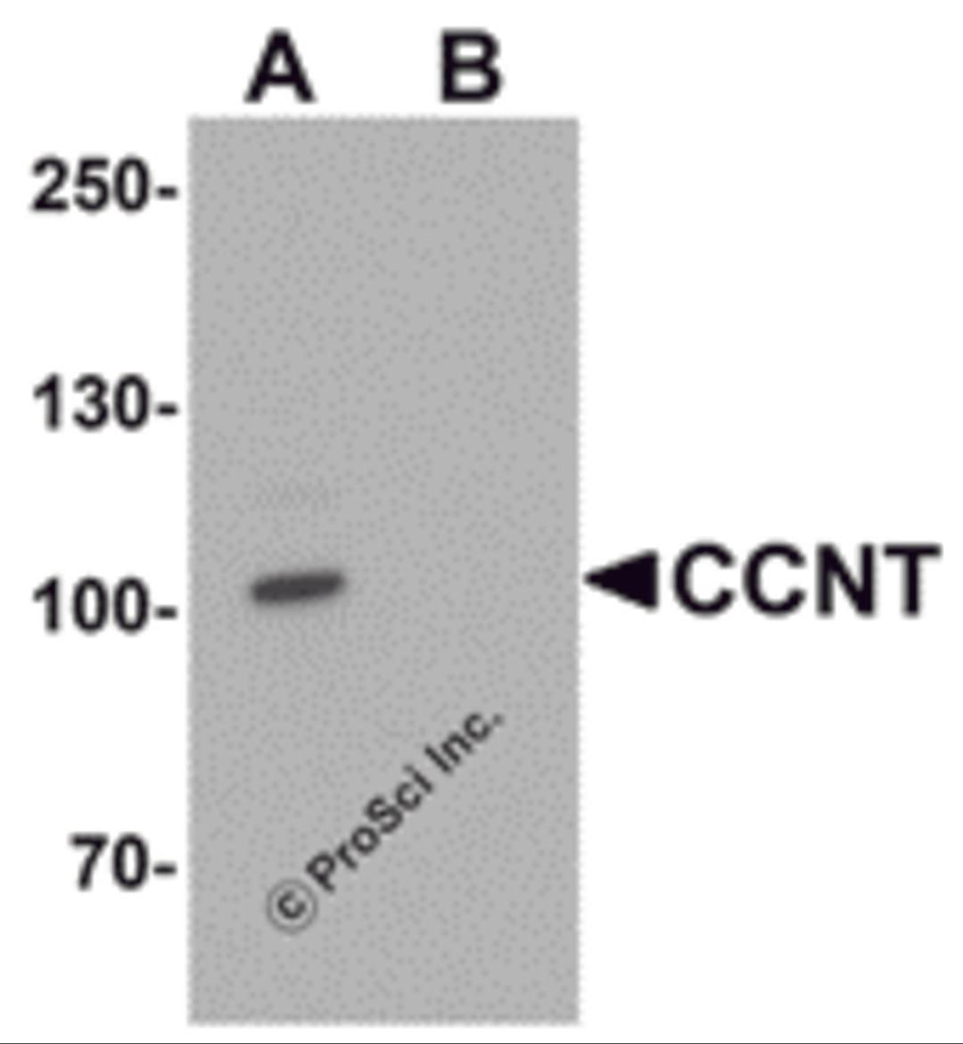 Western blot analysis of CCNT1 in rat brain tissue lysate with CCNT1 antibody at 1 μg/mL in (A) the absence and (B) the presence of blocking peptide.