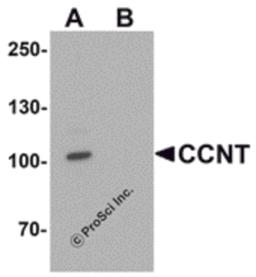 Western blot analysis of CCNT1 in rat brain tissue lysate with CCNT1 antibody at 1 μg/mL in (A) the absence and (B) the presence of blocking peptide.