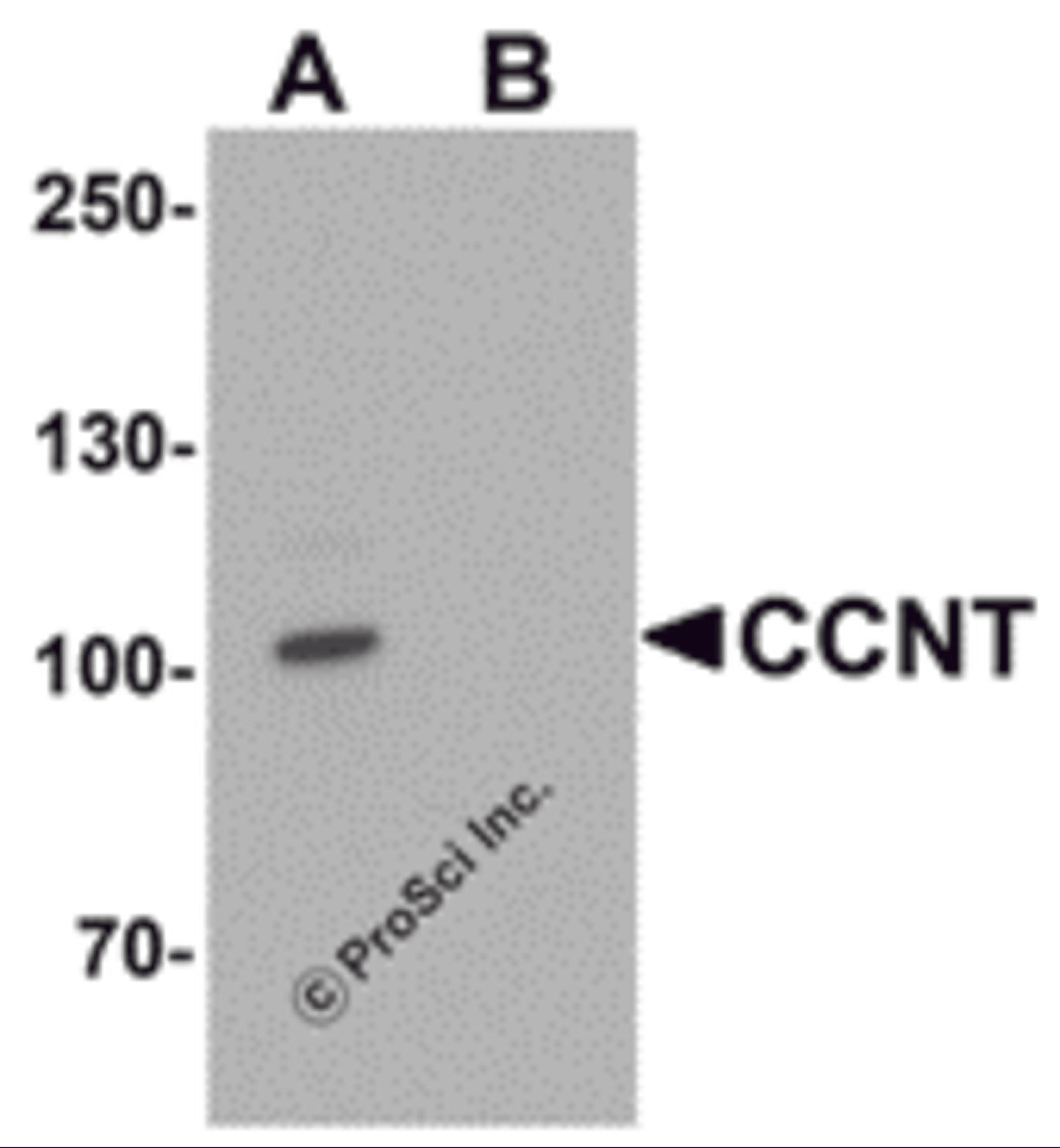 Western blot analysis of CCNT1 in rat brain tissue lysate with CCNT1 antibody at 1 μg/mL in (A) the absence and (B) the presence of blocking peptide.