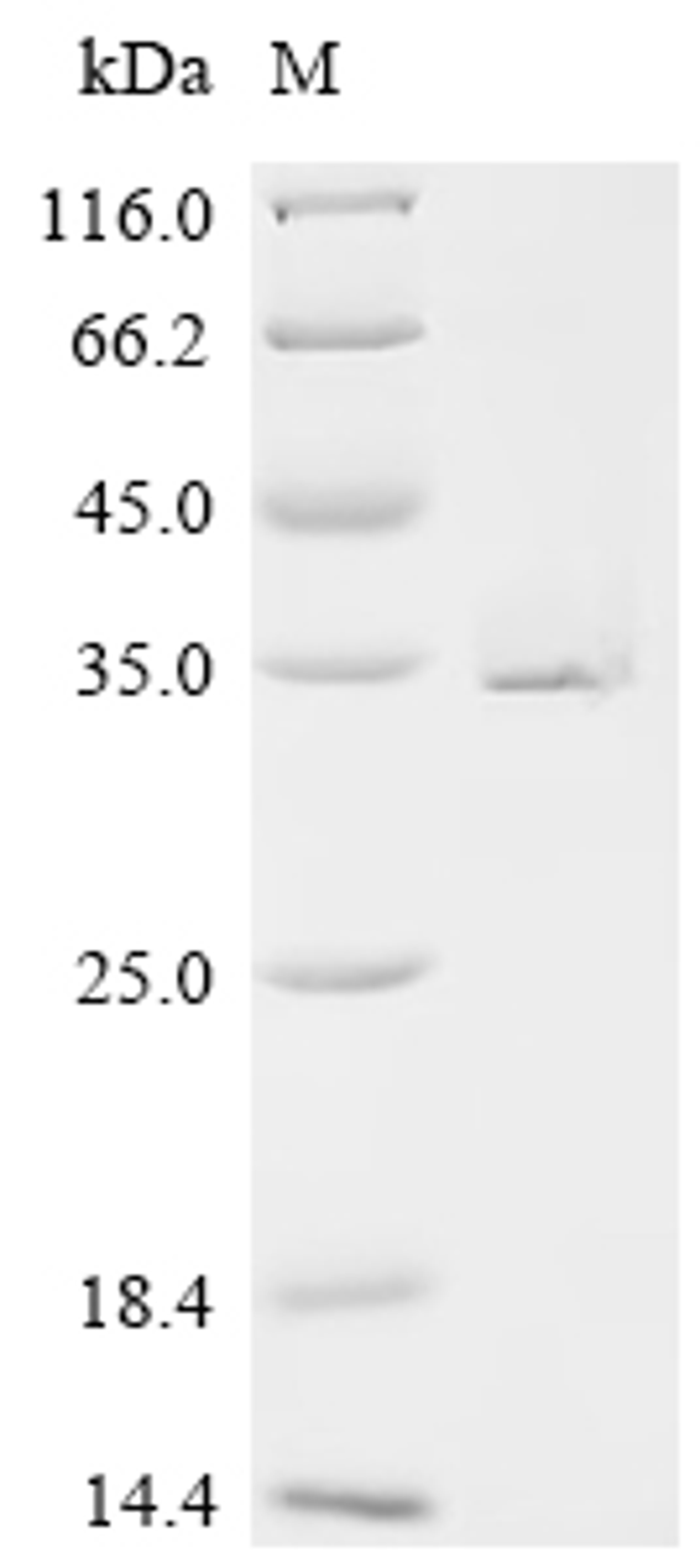 (Tris-Glycine gel) Discontinuous SDS-PAGE (reduced) with 5% enrichment gel and 15% separation gel.