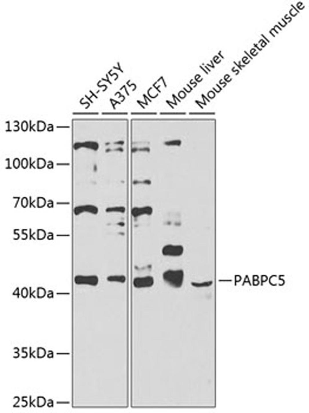 Western blot - PABPC5 antibody (A9997)