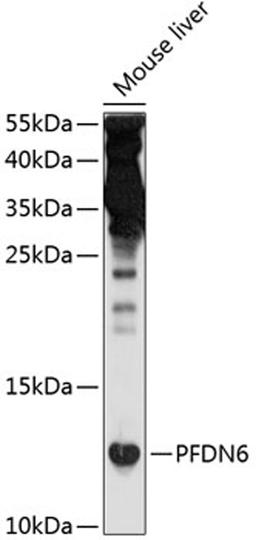 Western blot - PFDN6 antibody (A10580)