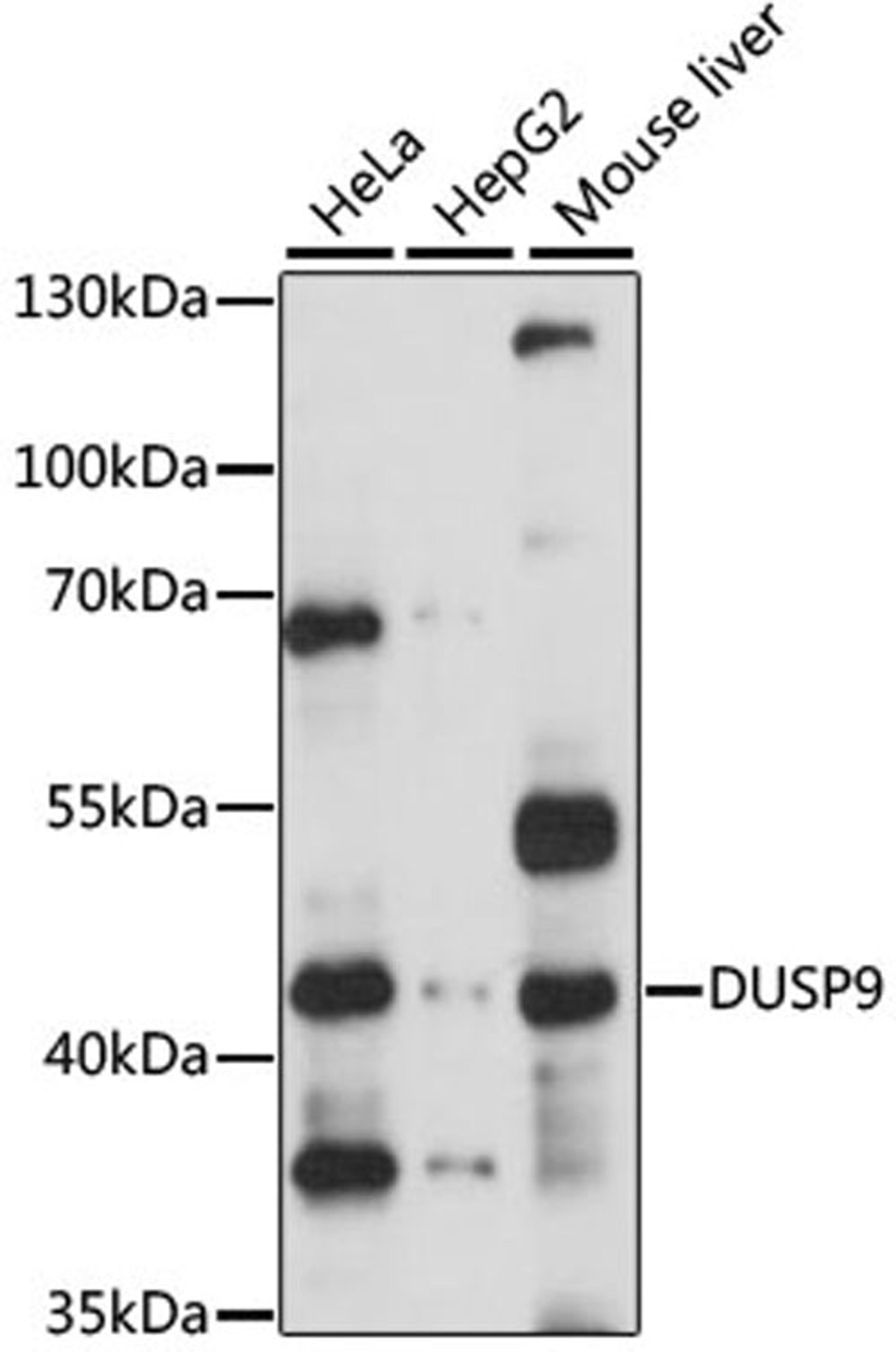 Western blot - DUSP9 antibody (A3839)