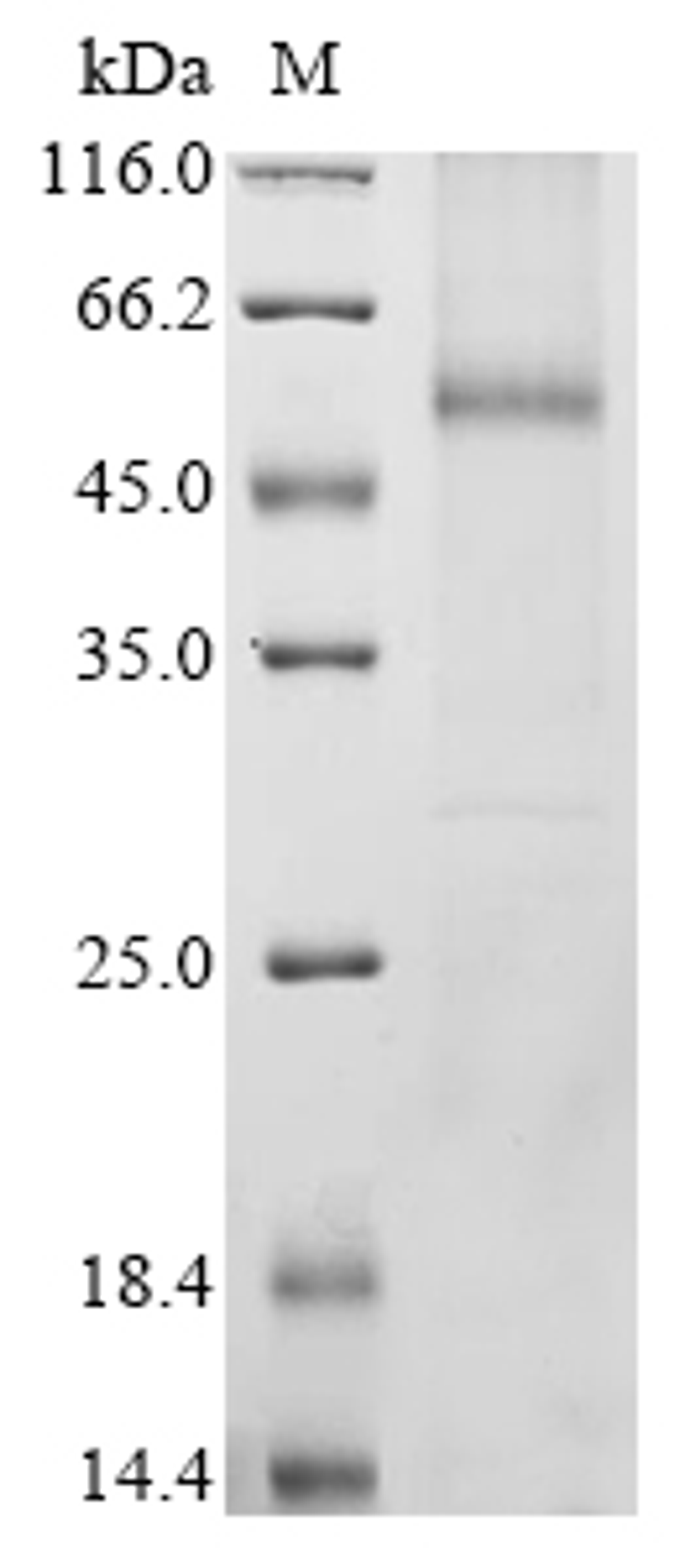 (Tris-Glycine gel) Discontinuous SDS-PAGE (reduced) with 5% enrichment gel and 15% separation gel.