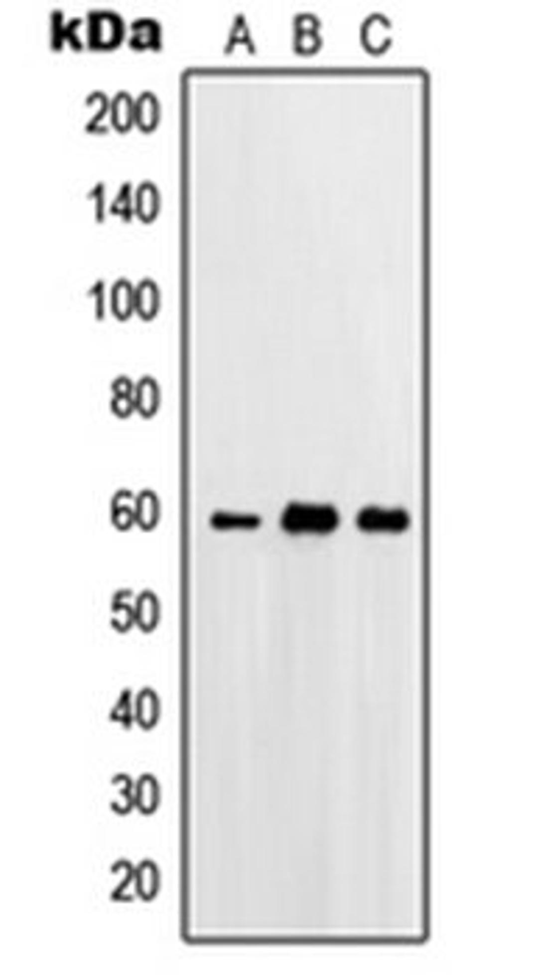 Western blot analysis of A431 (Lane 1), HeLa (Lane 2), A549 (Lane 3) whole cell lysates using PRKCSH antibody