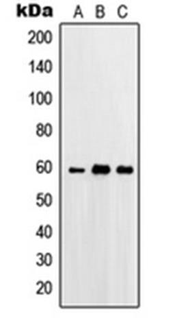 Western blot analysis of A431 (Lane 1), HeLa (Lane 2), A549 (Lane 3) whole cell lysates using PRKCSH antibody