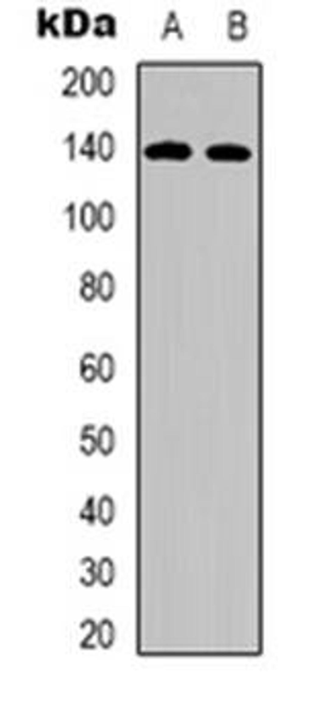 Western blot analysis of STAG3 expression in U251 (Lane 1), Jurkat (Lane 2) whole cell lysates using STAG3 antibody