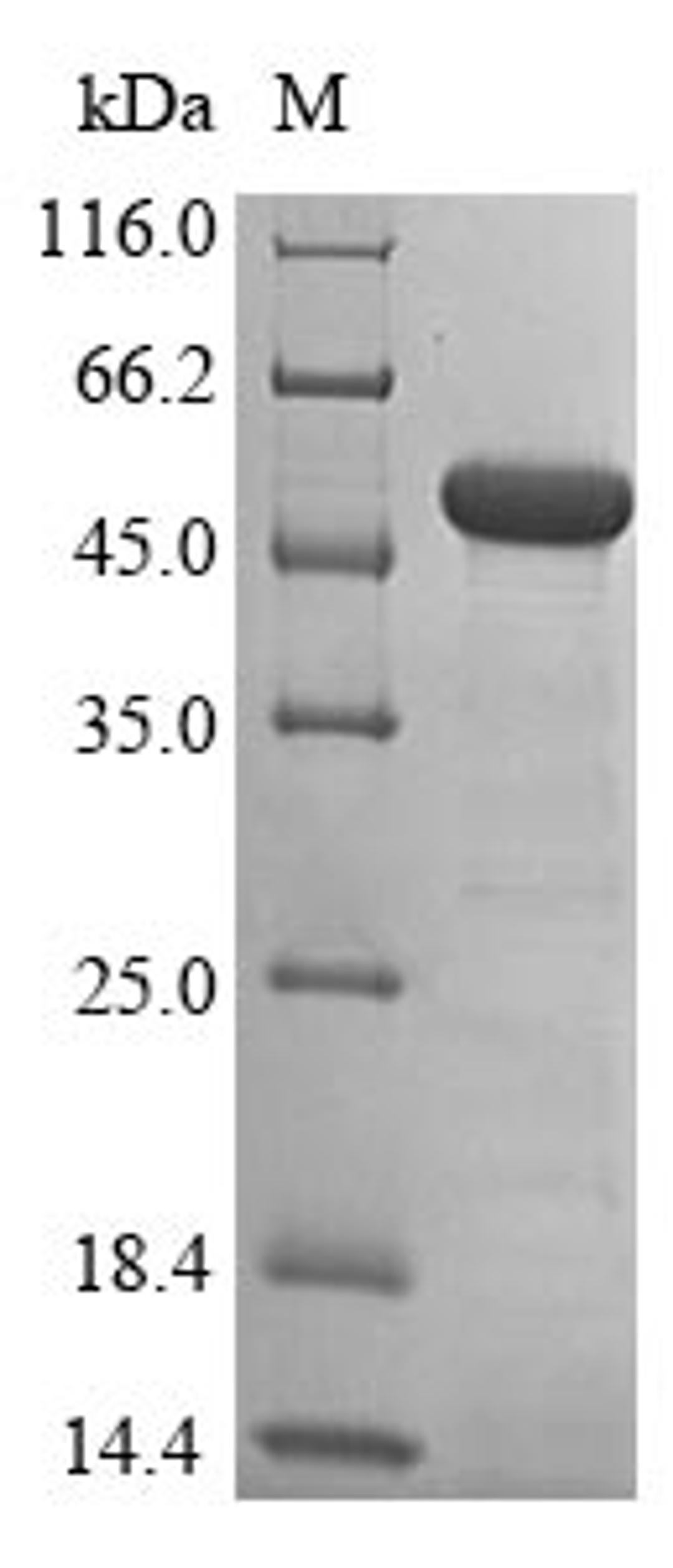 (Tris-Glycine gel) Discontinuous SDS-PAGE (reduced) with 5% enrichment gel and 15% separation gel.