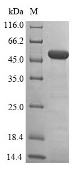 (Tris-Glycine gel) Discontinuous SDS-PAGE (reduced) with 5% enrichment gel and 15% separation gel.