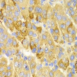 Immunohistochemical staining of rat brain tissue using LAMP3 antibody (dilution of 1:200)