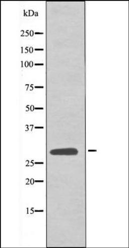 Western blot analysis of EGF treated 293 whole cell lysates using LAT -Phospho-Tyr161- antibody