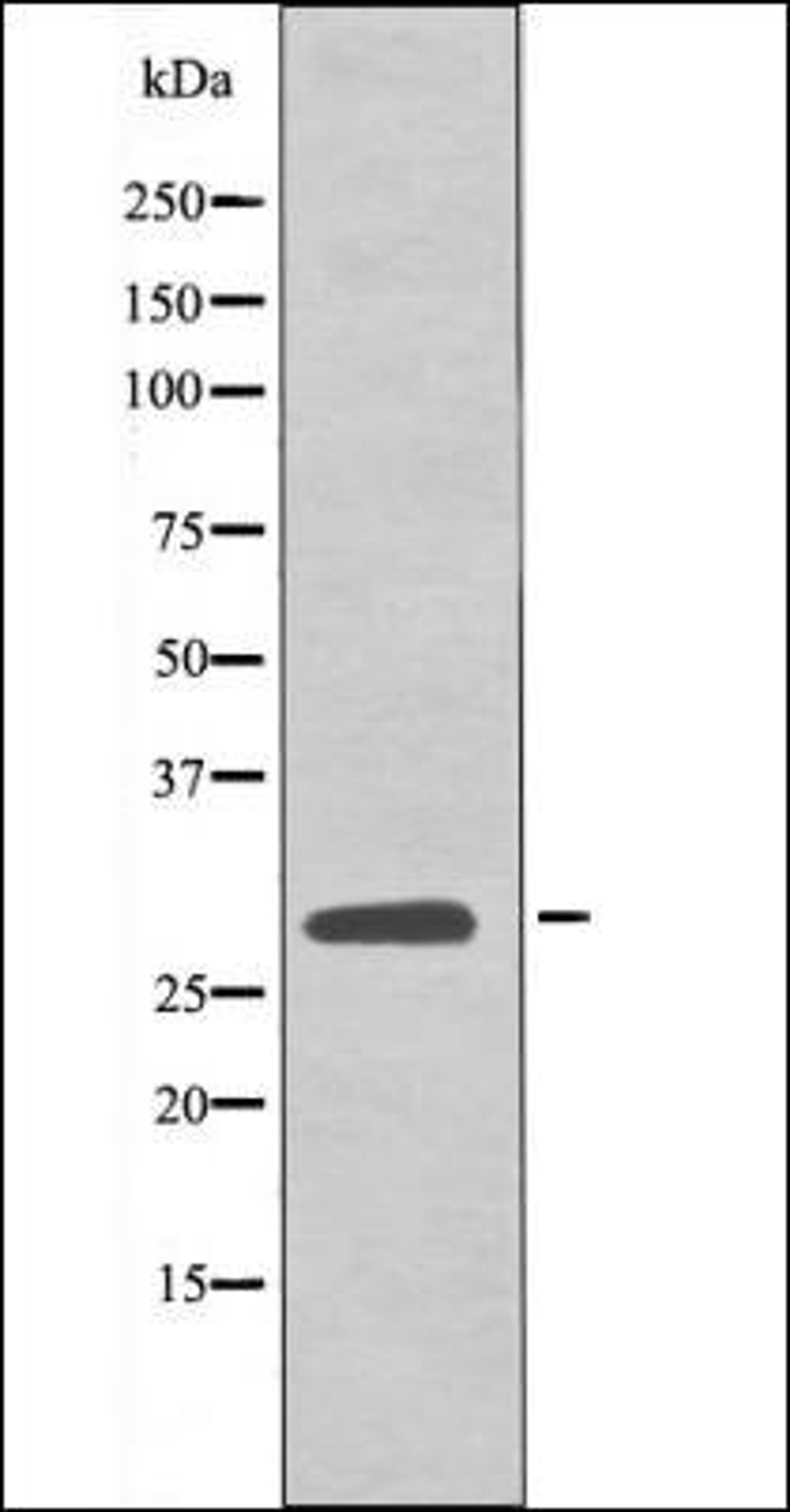 Western blot analysis of EGF treated 293 whole cell lysates using LAT -Phospho-Tyr161- antibody