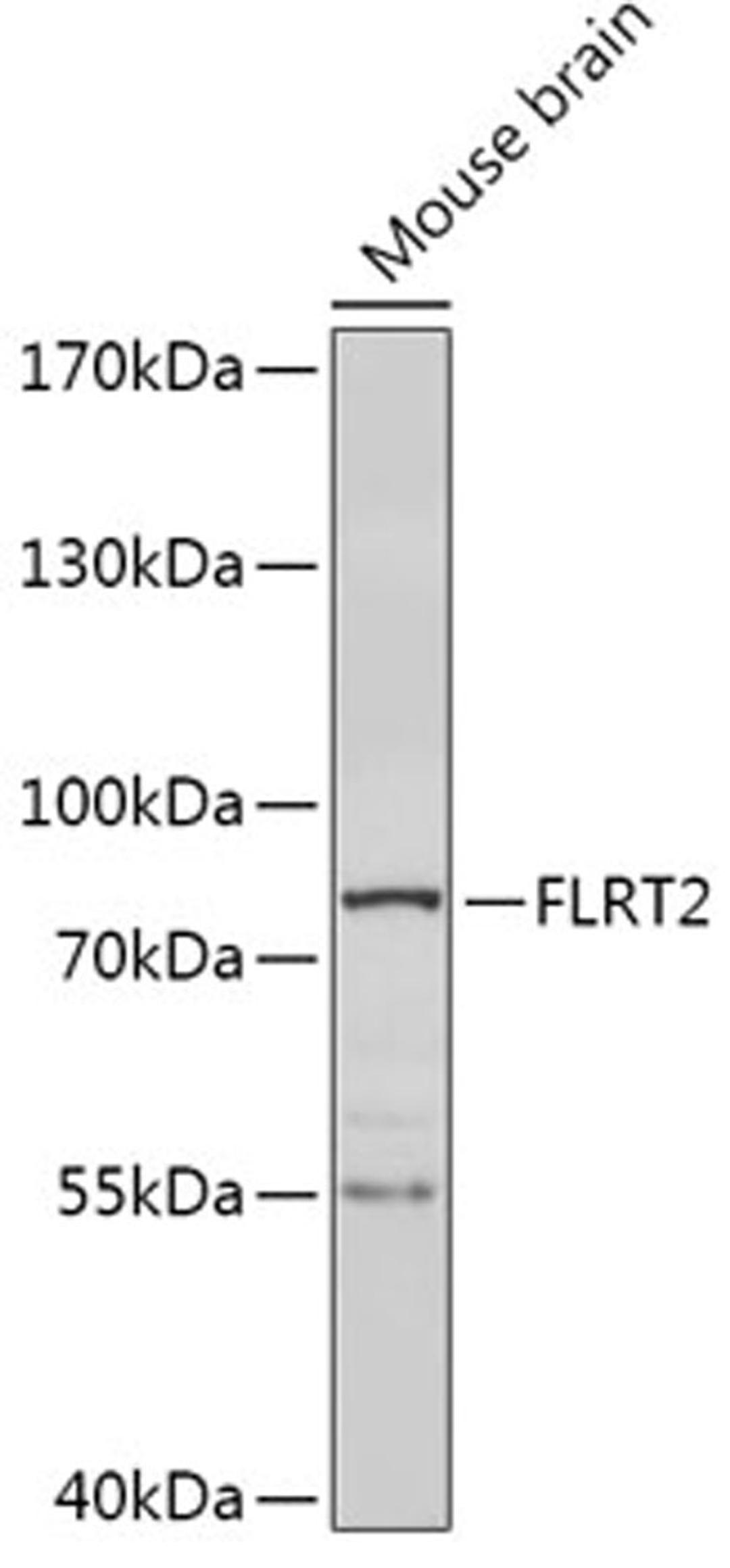 Western blot - FLRT2 antibody (A17668)