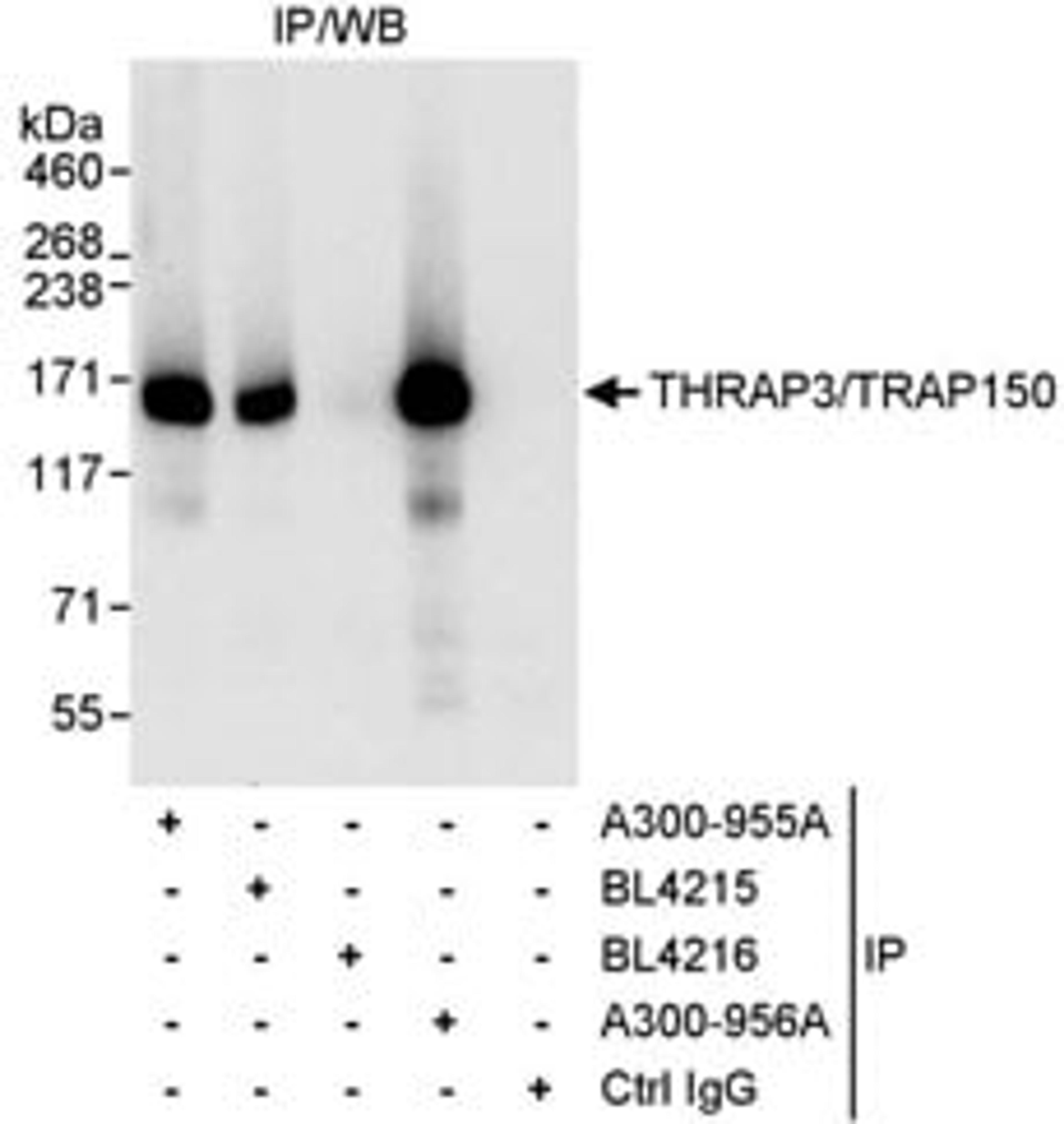 Detection of human THRAP3/TRAP150 by western blot of immunoprecipitates.