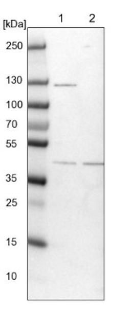 Western Blot: TFAP4 Antibody [NBP1-89060] - Lane 1: NIH-3T3 cell lysate (Mouse embryonic fibroblast cells)<br/>Lane 2: NBT-II cell lysate (Rat Wistar bladder tumour cells)