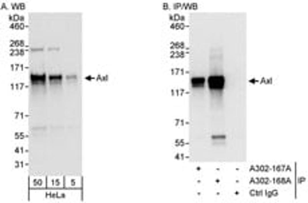 Detection of human Axl by western blot and immunoprecipitation.