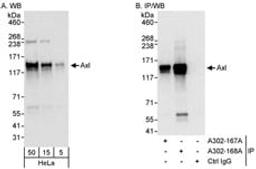 Detection of human Axl by western blot and immunoprecipitation.