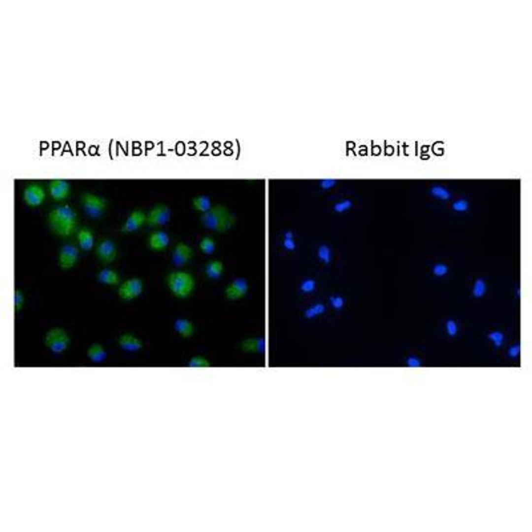 Immunocytochemistry/Immunofluorescence: PPAR alpha/NR1C1 Antibody [NBP1-03288] - PPAR alpha Antibody [NBP1-03288] - Staining of human primary macrophages using NBP1-03288 at a dilution of 1/100. Photo courtesy of a product review by verified customer.