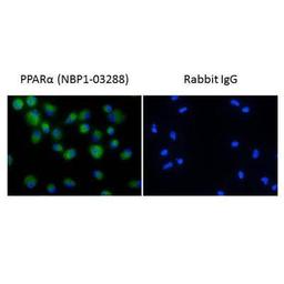 Immunocytochemistry/Immunofluorescence: PPAR alpha/NR1C1 Antibody [NBP1-03288] - PPAR alpha Antibody [NBP1-03288] - Staining of human primary macrophages using NBP1-03288 at a dilution of 1/100. Photo courtesy of a product review by verified customer.