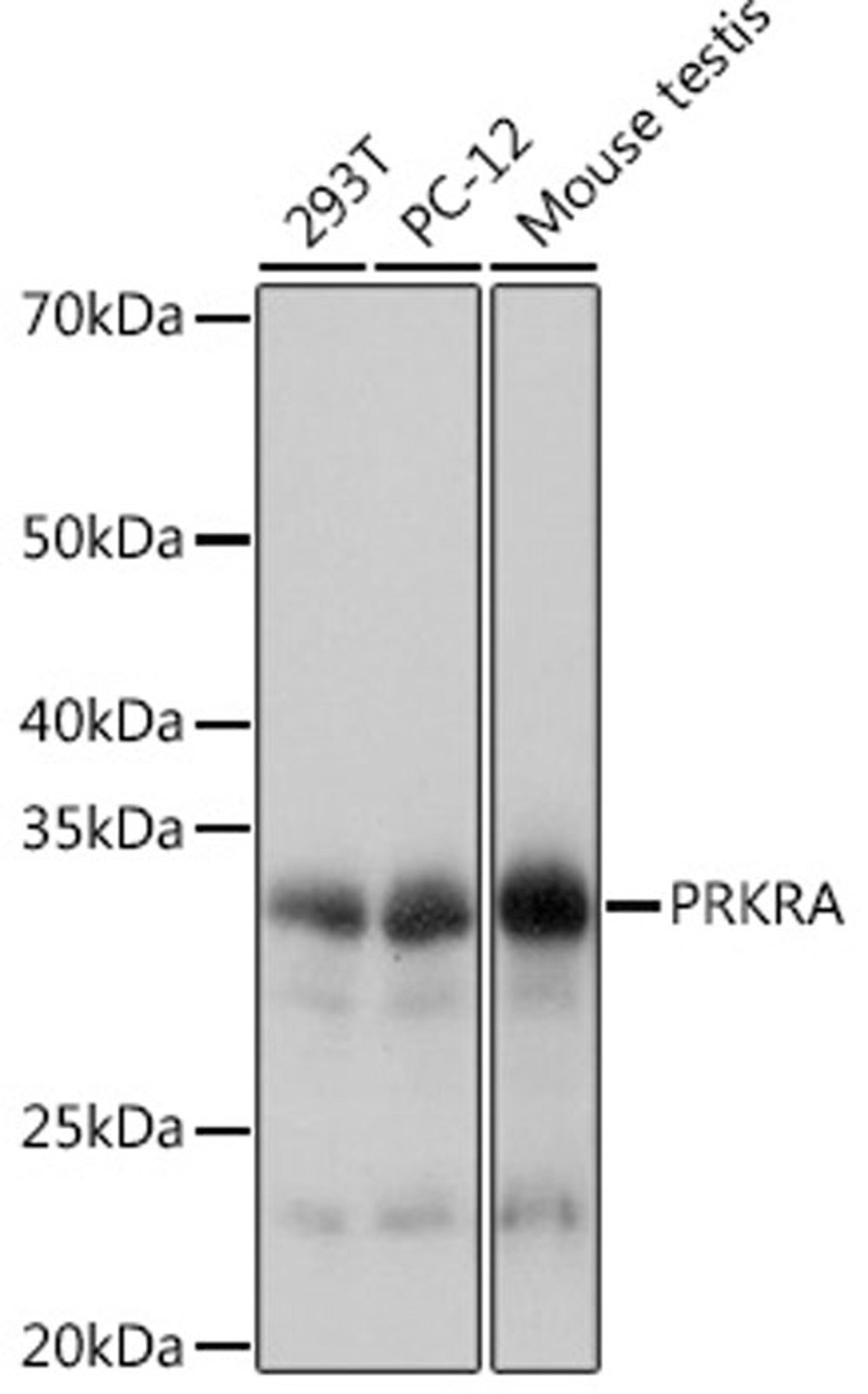 Western blot - PRKRA Rabbit mAb (A8779)