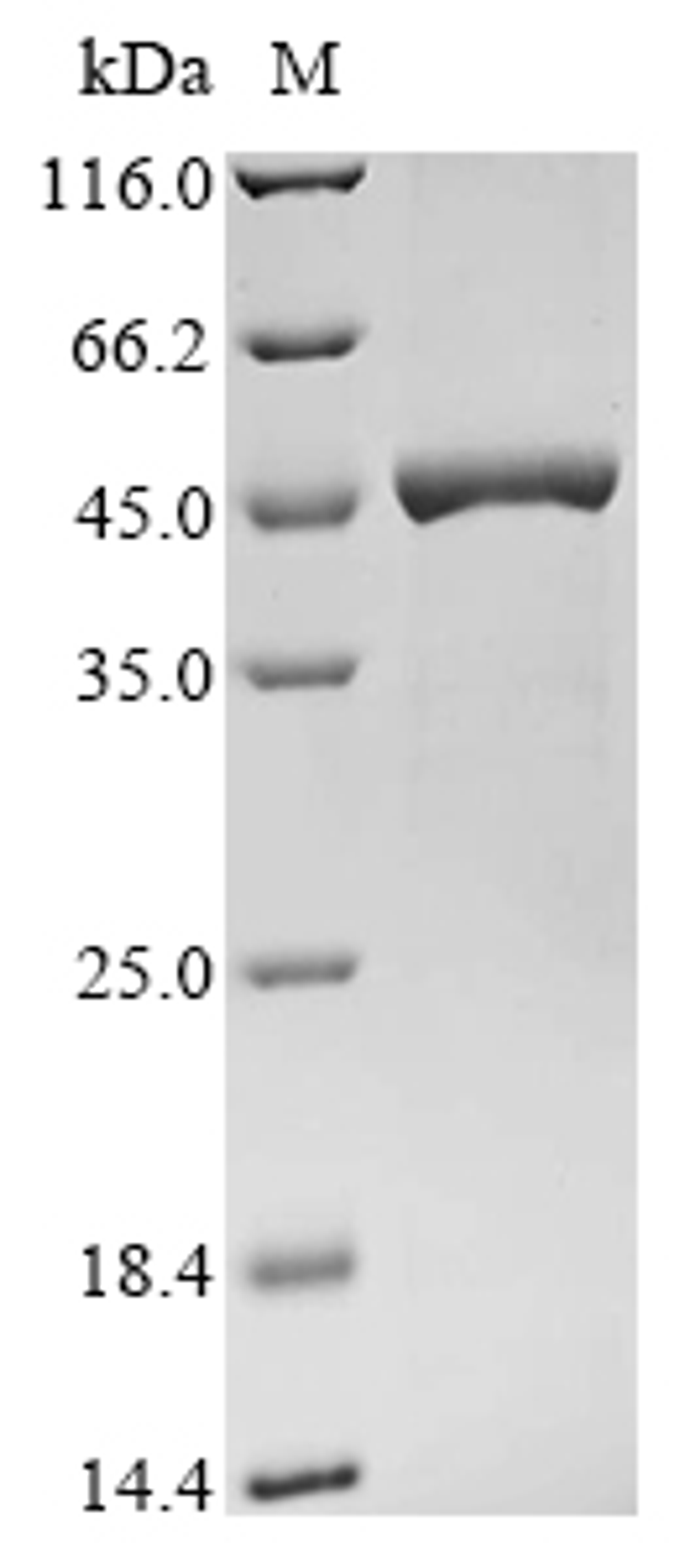 (Tris-Glycine gel) Discontinuous SDS-PAGE (reduced) with 5% enrichment gel and 15% separation gel.
