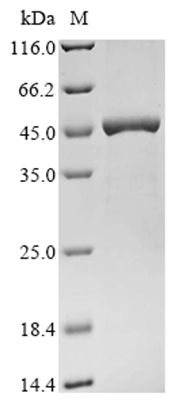 (Tris-Glycine gel) Discontinuous SDS-PAGE (reduced) with 5% enrichment gel and 15% separation gel.
