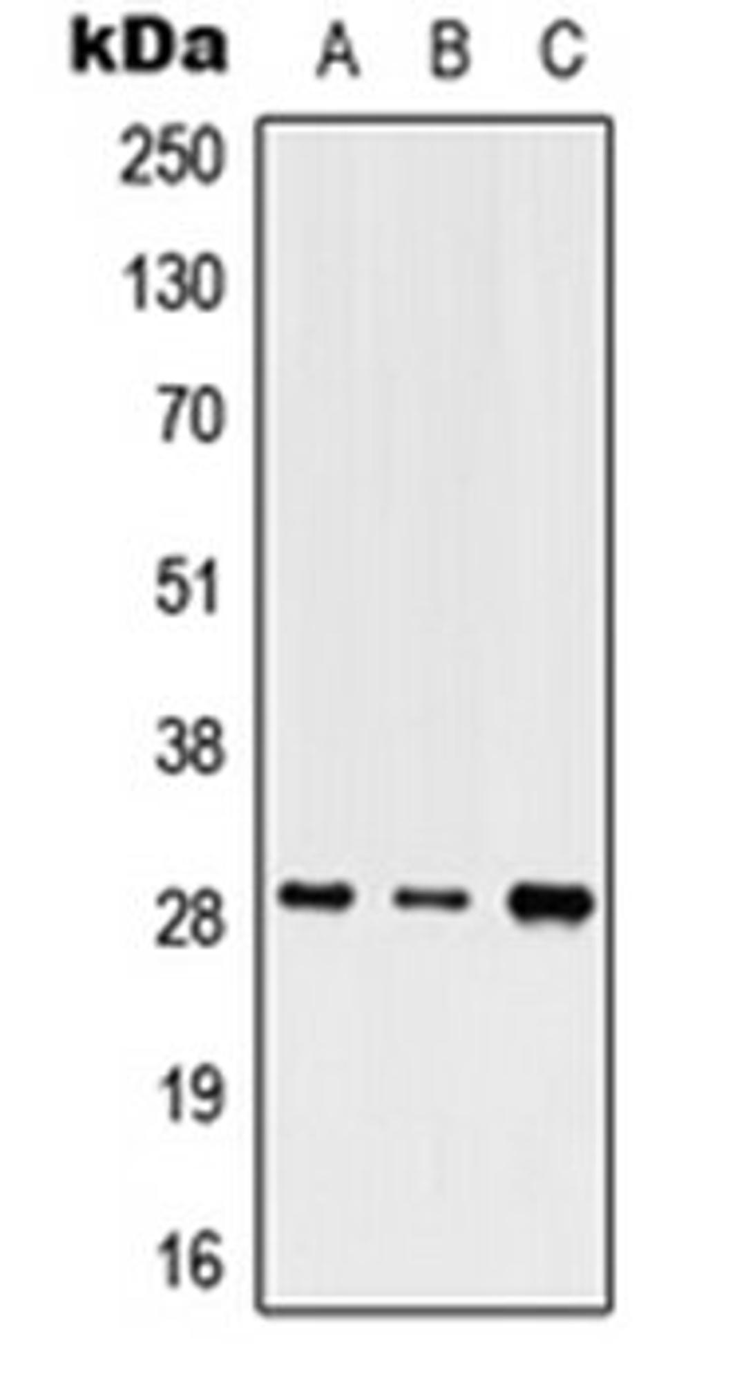 Western blot analysis of HEK293T (Lane 1), Raw264.7 (Lane 2), SP2/0 (Lane 3) whole cell lysates using SHOX antibody