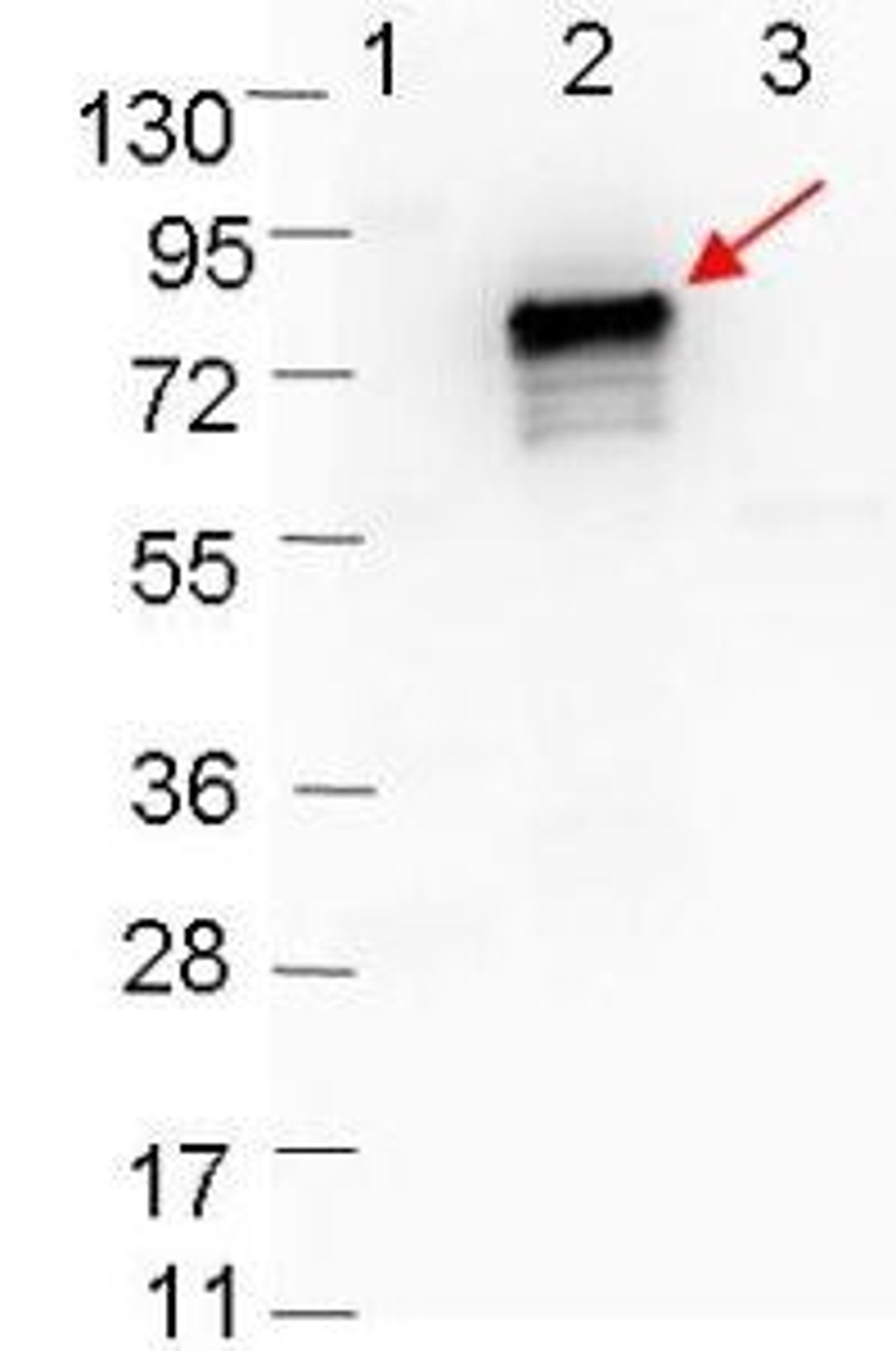 Western blot analysis of Lane 1: Molecular weight markers. Lane 2: MBP-OspB fusion protein (arrow; expected MW = 72.7 kDa). Lane 3: MBP alone using OspB antibody