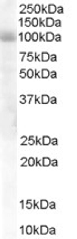 45-745 staining (1ug/ml) of Human Lung lysate (RIPA buffer, 30ug total protein per lane). Primary incubated for 1 hour. Detected by western blot using chemiluminescence.