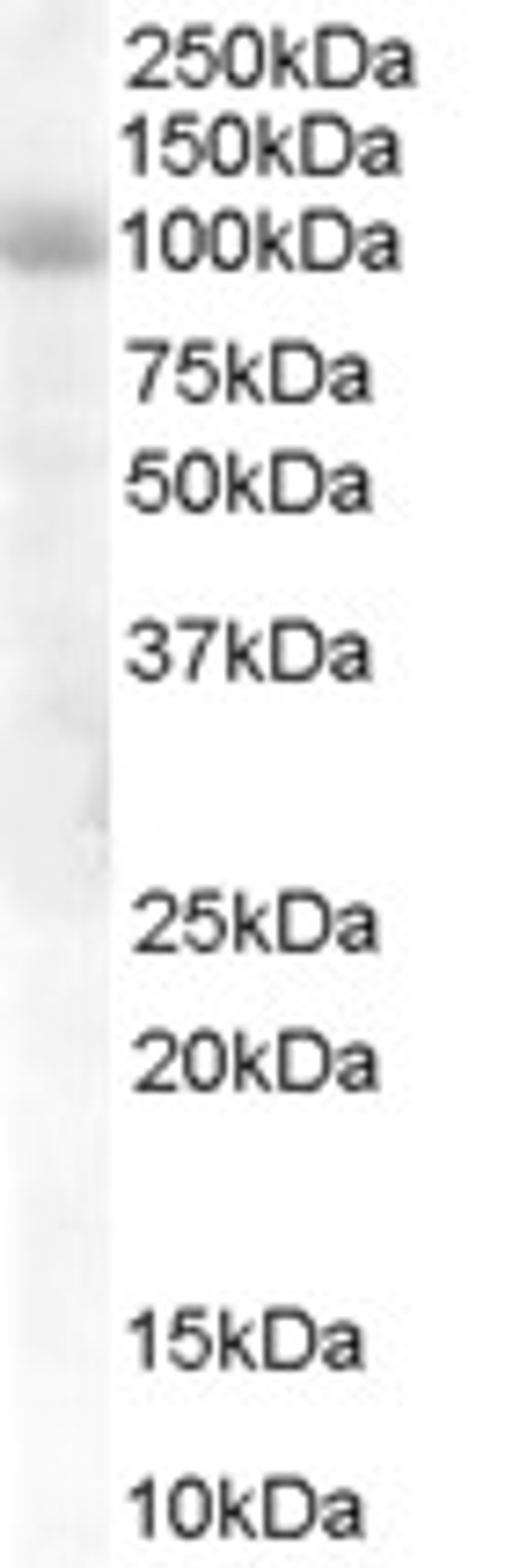 45-745 staining (1ug/ml) of Human Lung lysate (RIPA buffer, 30ug total protein per lane). Primary incubated for 1 hour. Detected by western blot using chemiluminescence.