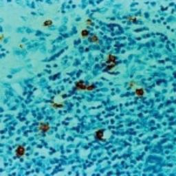 Immunohistochemistry-Paraffin: Mast Cell Tryptase Antibody (AA1) [NBP2-26444] - IHC analysis of Mast Cell Tryptase formalin-fixed paraffin embedded human tonsil using NBP2-26444.