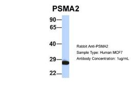 Western Blot: Proteasome 20S alpha 2 Antibody [NBP1-54633] - MCF7, Antibody Dilution: 1.0 ug/ml There is BioGPS gene expression data showing that PSMA2 is expressed in MCF7.