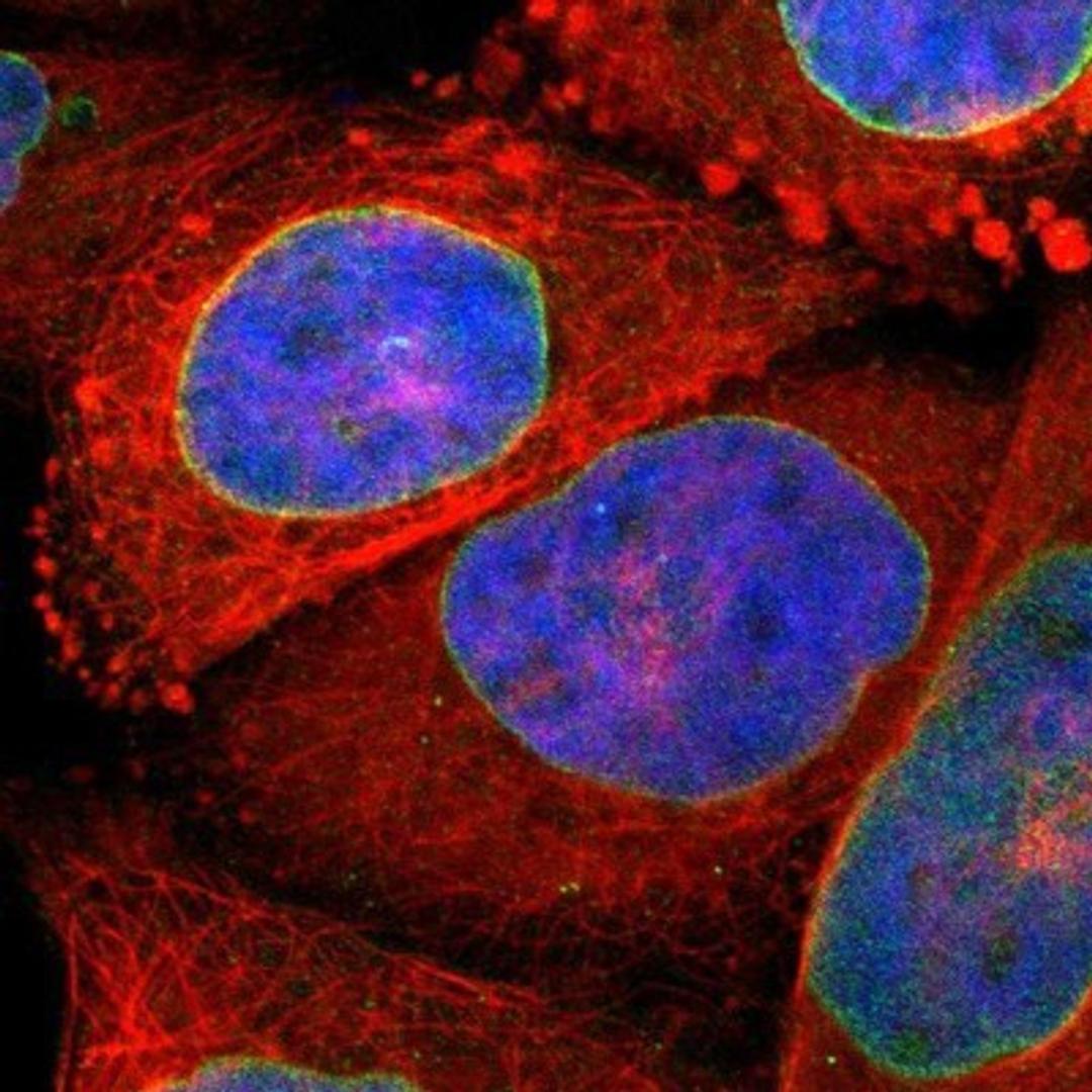 Immunocytochemistry/Immunofluorescence: SUN1 Antibody [NBP1-87396] - Staining of human cell line A-431 shows positivity in nuclear membrane.