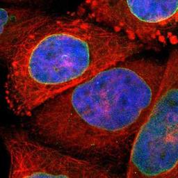 Immunocytochemistry/Immunofluorescence: SUN1 Antibody [NBP1-87396] - Staining of human cell line A-431 shows positivity in nuclear membrane.