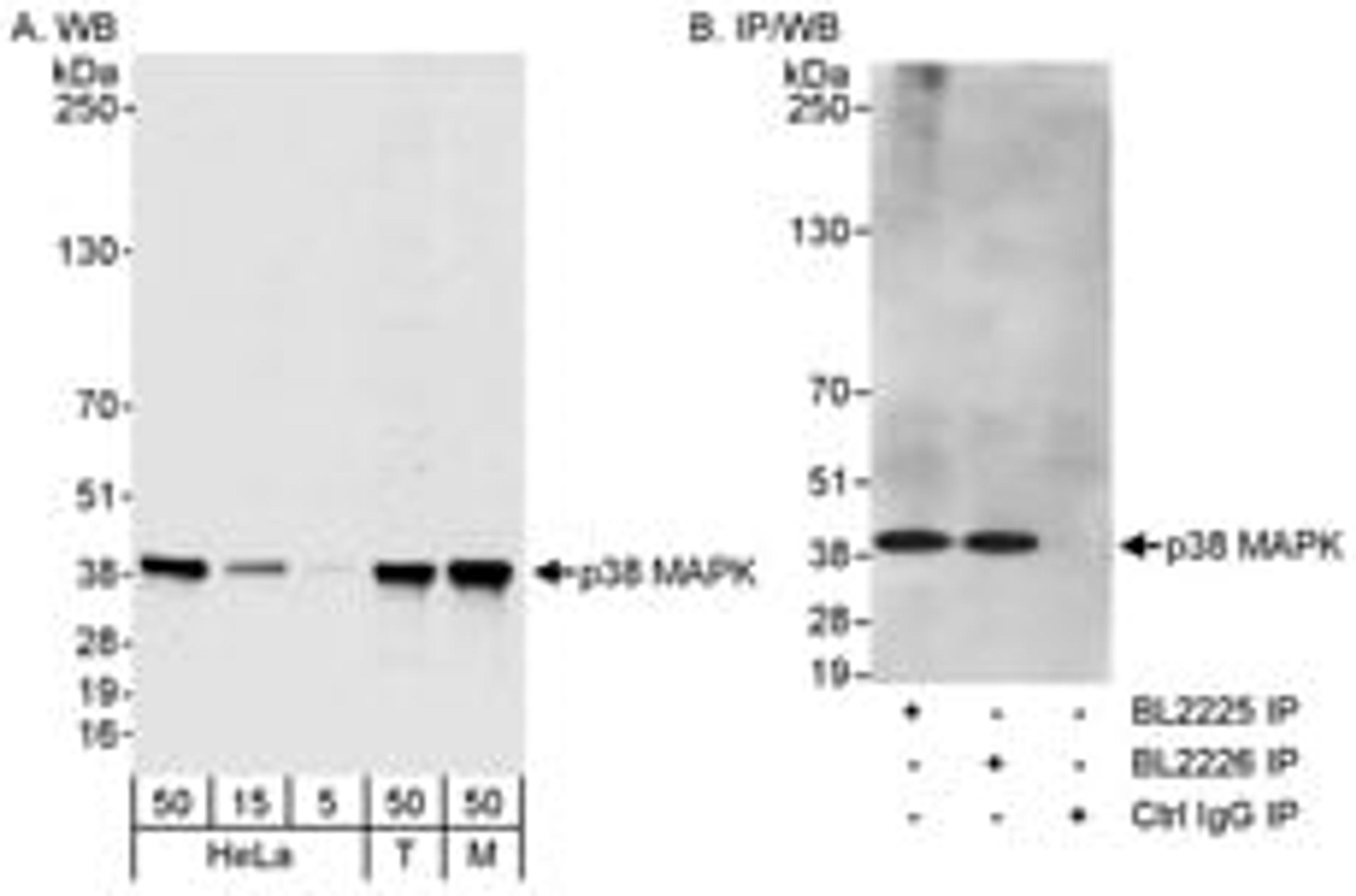 Detection of human and mouse p38 MAPK by western blot (h&m) and immunoprecipitation (h).