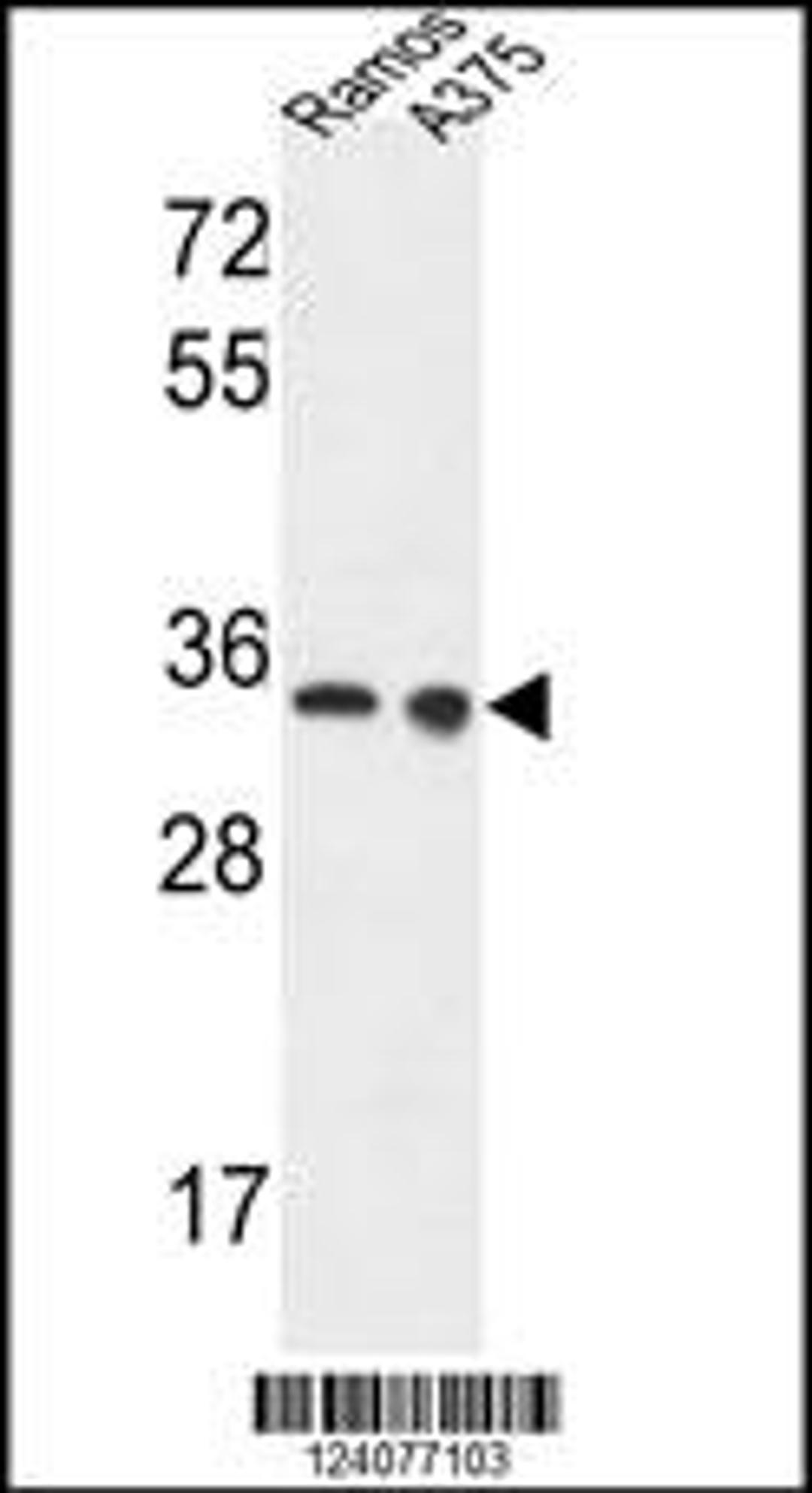 Western blot analysis in Ramos,A375 cell line lysates (35ug/lane).