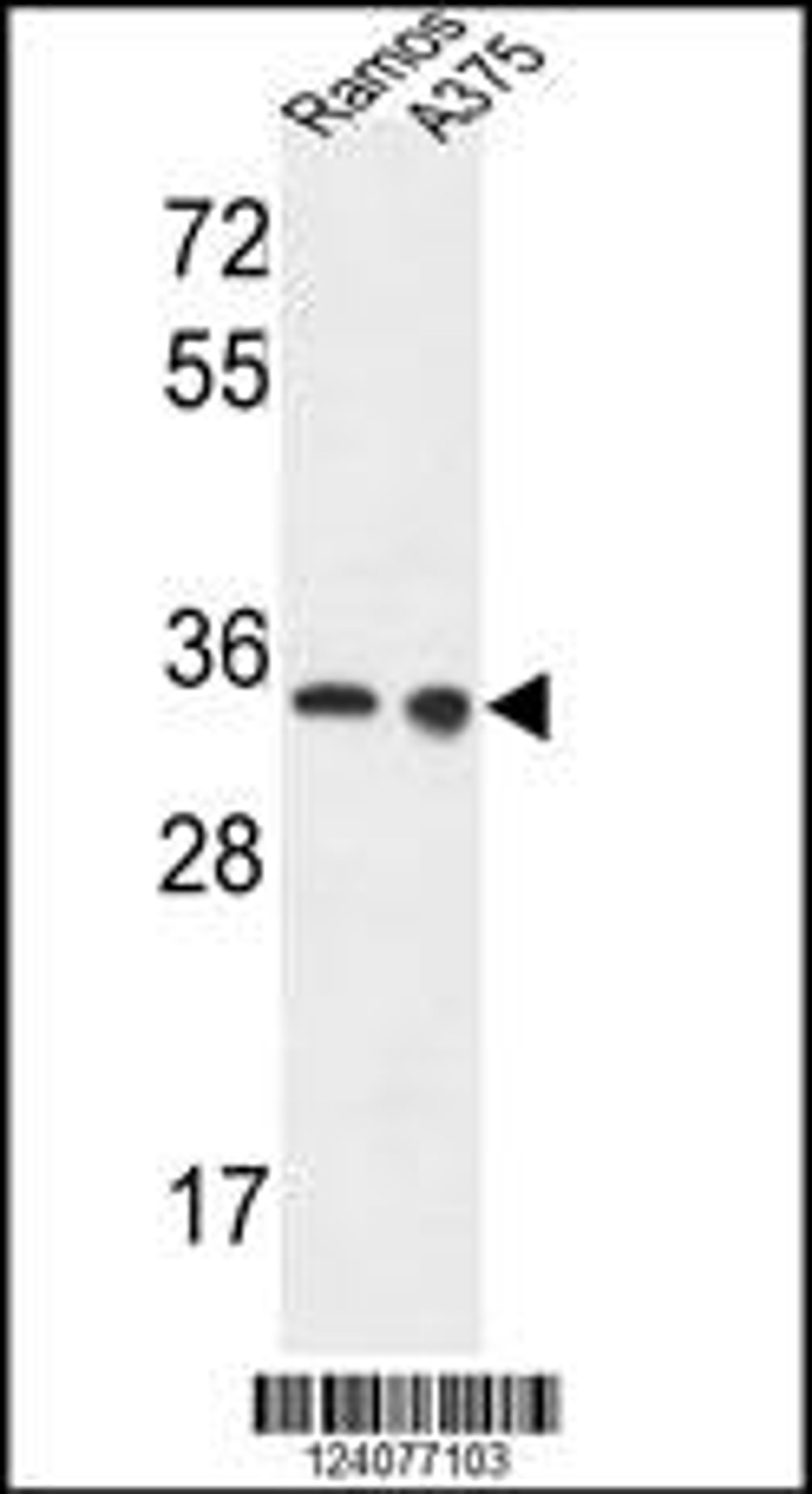 Western blot analysis in Ramos,A375 cell line lysates (35ug/lane).