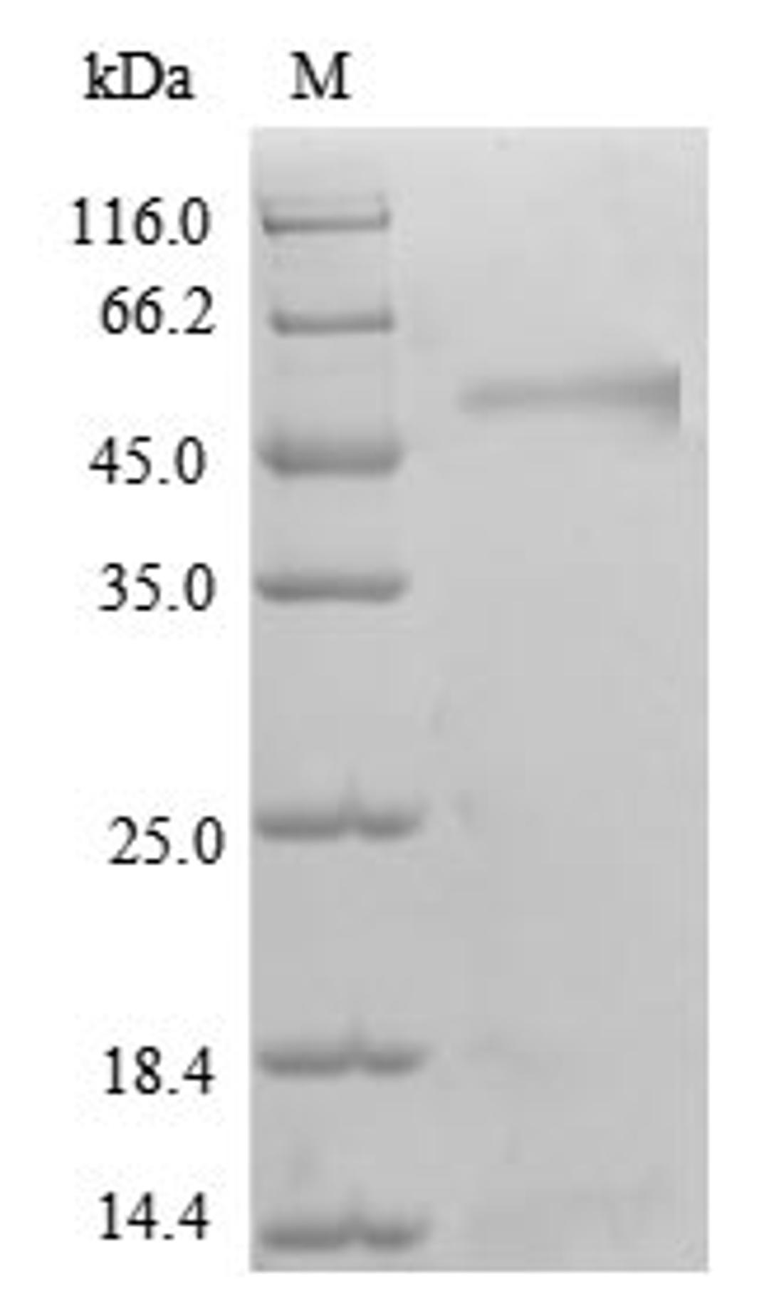 (Tris-Glycine gel) Discontinuous SDS-PAGE (reduced) with 5% enrichment gel and 15% separation gel.