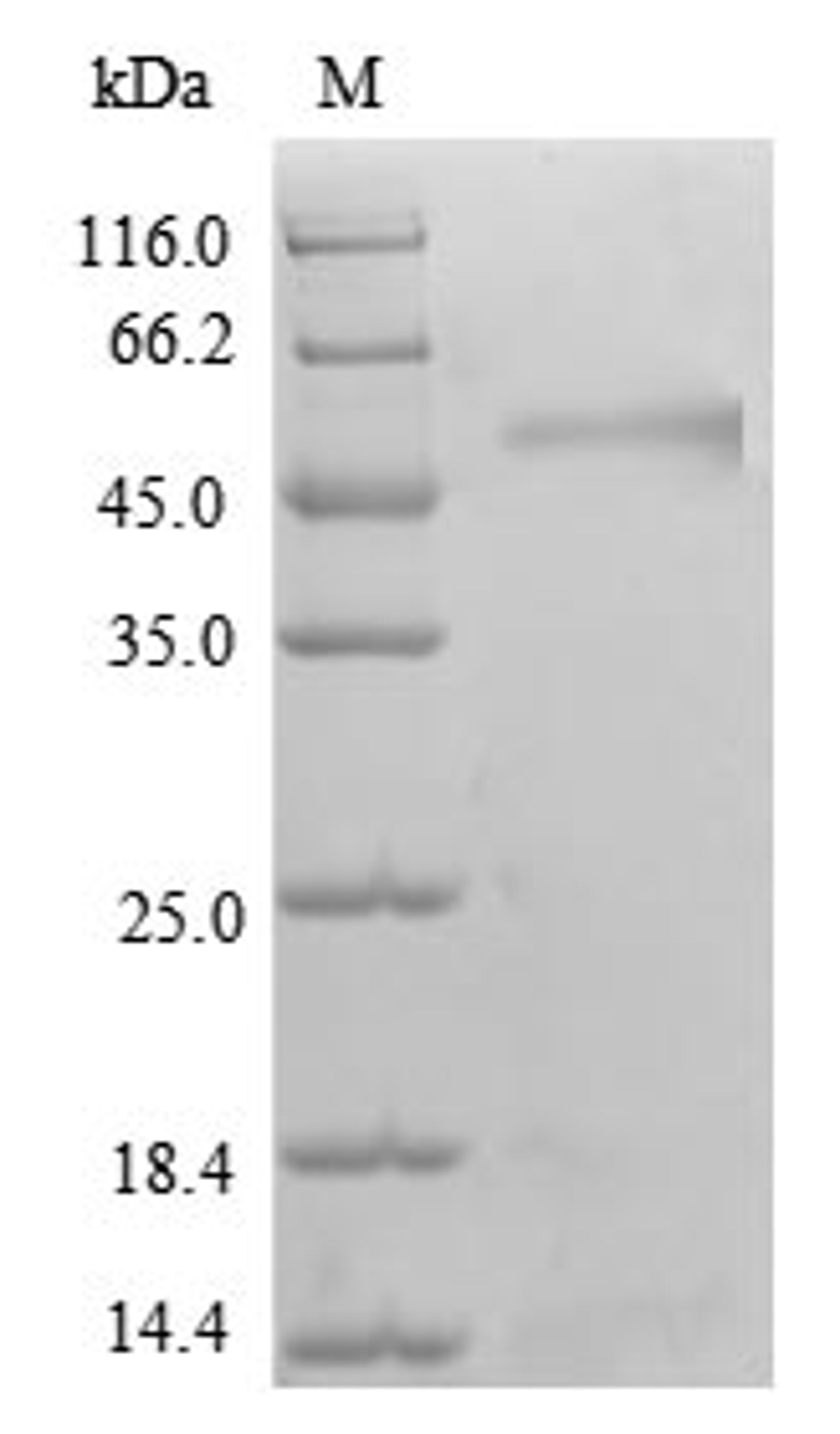 (Tris-Glycine gel) Discontinuous SDS-PAGE (reduced) with 5% enrichment gel and 15% separation gel.