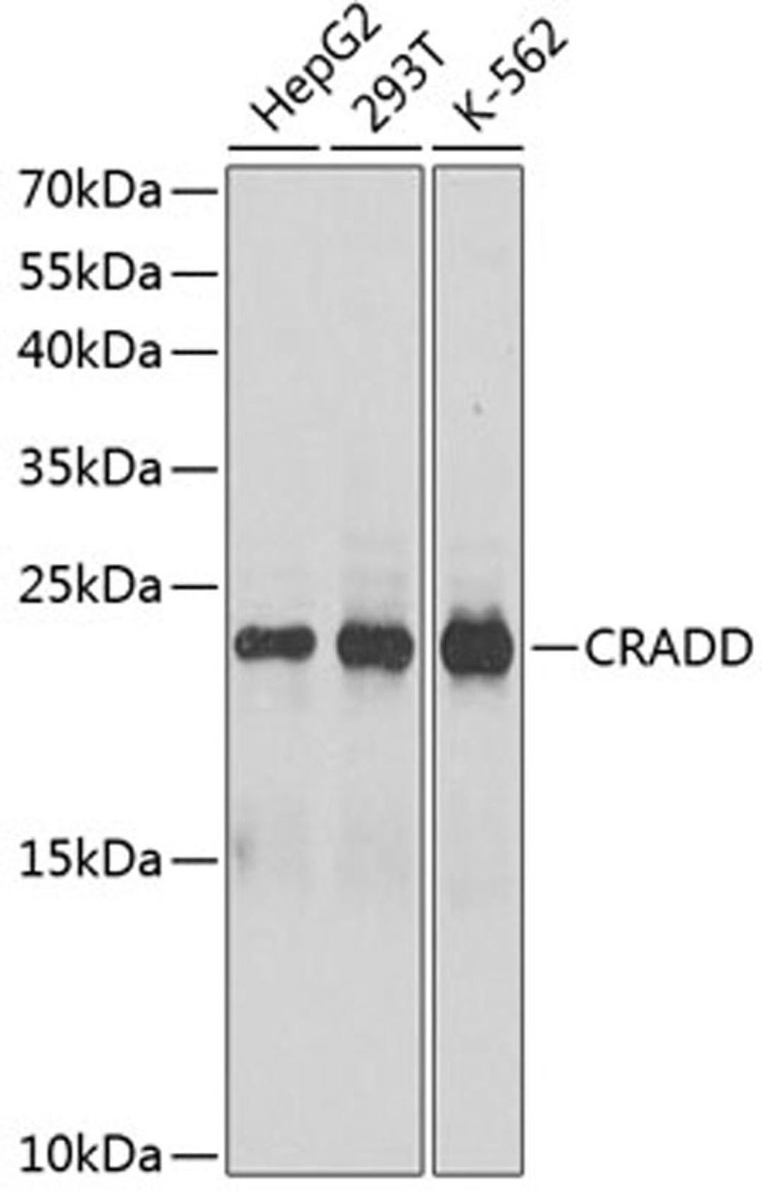 Western blot - CRADD antibody (A1124)