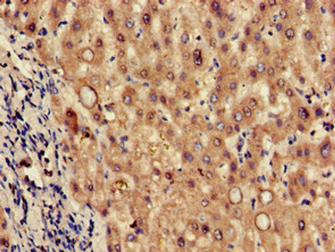 Immunohistochemistry of paraffin-embedded human liver tissue using CSB-PA809000LA01HU at dilution of 1:100