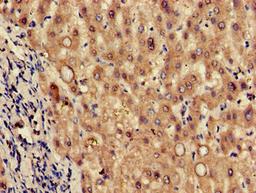 Immunohistochemistry of paraffin-embedded human liver tissue using CSB-PA809000LA01HU at dilution of 1:100