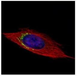 Immunocytochemistry/Immunofluorescence: GGCX Antibody [NBP2-16651] - Confocal immunofluorescence analysis of methanol-fixed HeLa, using GGCX antibody (Green) at 1:500 dilution. Alpha-tubulin filaments are labeled with Alpha-tubulin antibody (Red) at 1:2000.