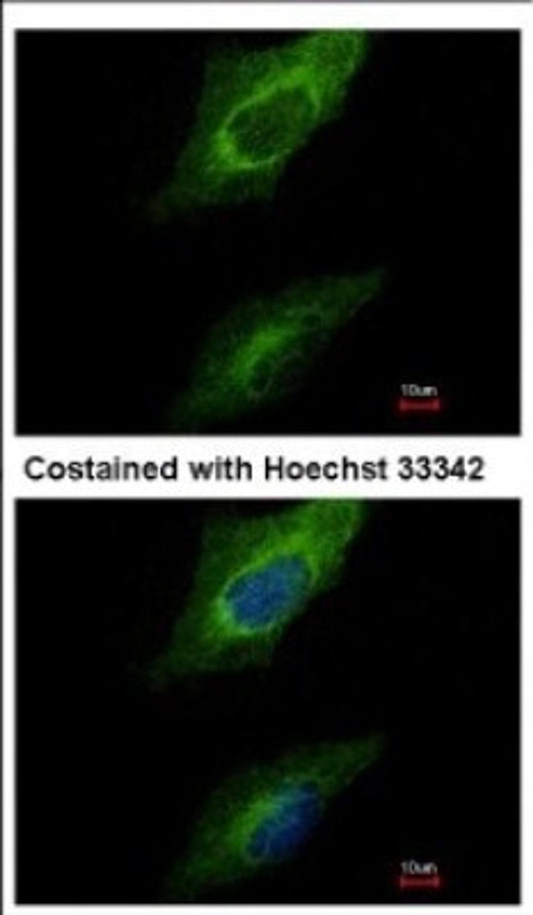 Immunocytochemistry/Immunofluorescence: Protein kinase-like protein SgK493 Antibody [NBP2-19959] - Immunofluorescence analysis of methanol-fixed HeLa, using antibody at 1:500 dilution.