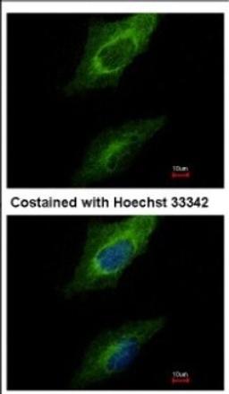 Immunocytochemistry/Immunofluorescence: Protein kinase-like protein SgK493 Antibody [NBP2-19959] - Immunofluorescence analysis of methanol-fixed HeLa, using antibody at 1:500 dilution.