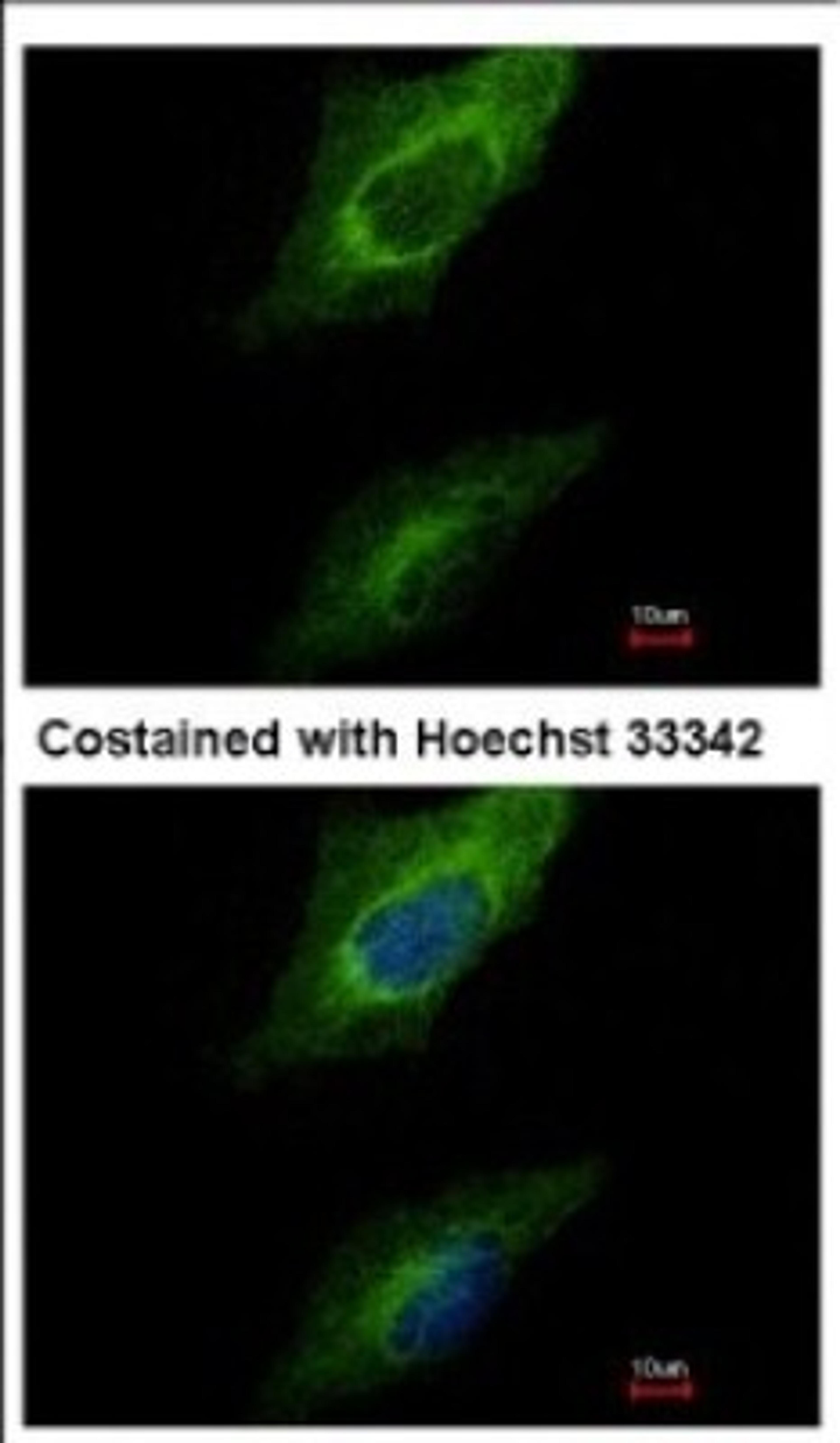 Immunocytochemistry/Immunofluorescence: Protein kinase-like protein SgK493 Antibody [NBP2-19959] - Immunofluorescence analysis of methanol-fixed HeLa, using antibody at 1:500 dilution.