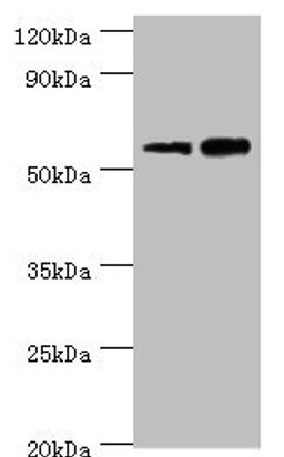 Western blot. All lanes: Non-syndromic hearing impairment protein 5 antibody at 10ug/ml. Lane 1: Hela whole cell lysate. Lane 2: HepG2 whole cell lysate. Secondary. Goat polyclonal to rabbit IgG at 1/10000 dilution. Predicted band size: 55, 11, 37 kDa. Observed band size: 55 kDa. 