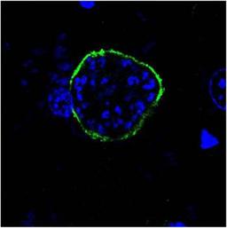 Confocal immunofluorescence analysis of liver sections of a B6 mice infected with Plasmodium Berghei ANKA parasites using UIS4 antibody