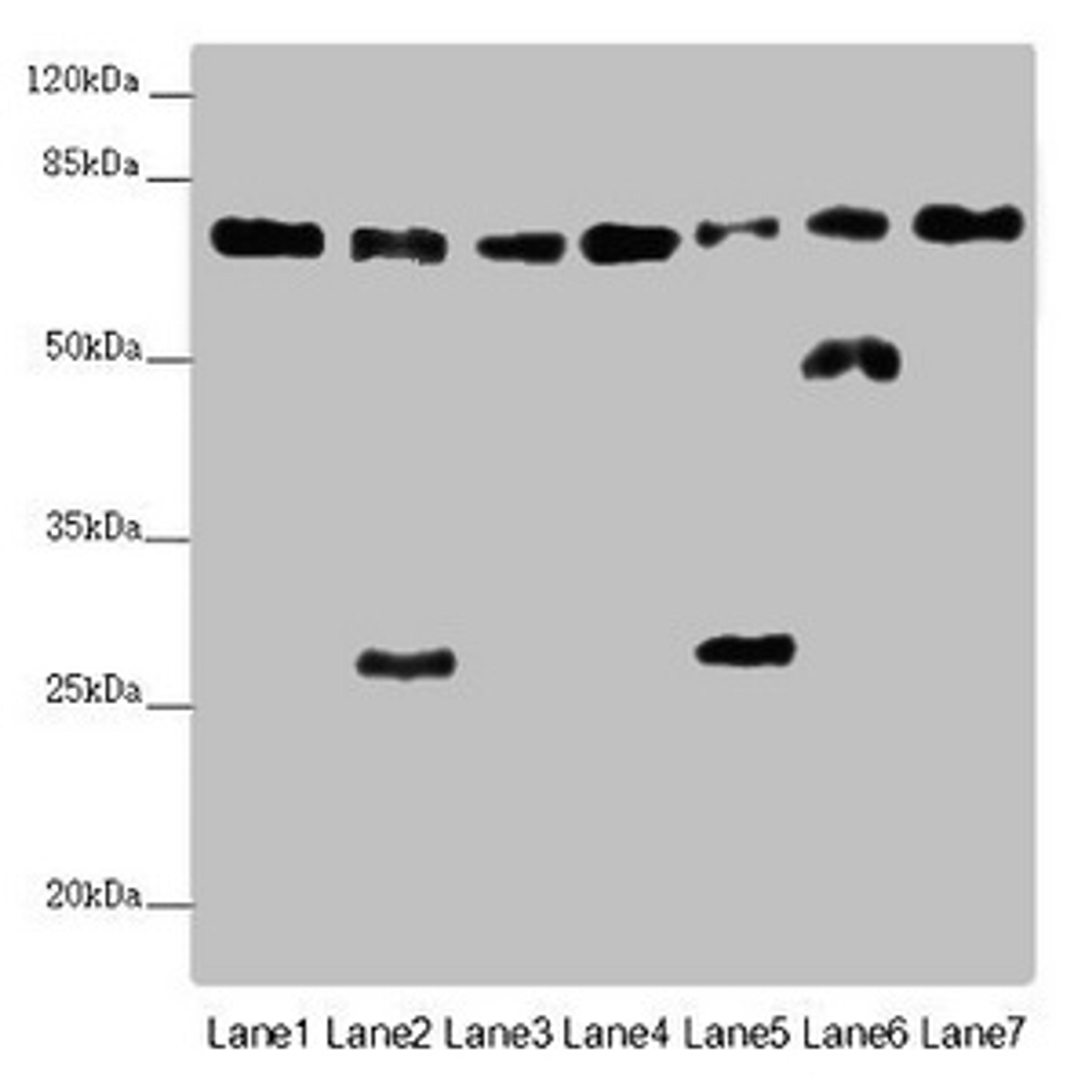 Western blot. All lanes: ALB antibody at 2 ug/ml. Lane 1: Mouse heart tissue. Lane 2: Mouse liver tissue. Lane 3: Mouse spleen tissue. Lane 4: Mouse lung tissue. Lane 5: Mouse kidney tissue. Lane 6: Mouse brain tissue. Lane 7: Mouse skeletal muscle tissue. Secondary. Goat polyclonal to rabbit IgG at 1/10000 dilution. Predicted band size: 70, 48, 46 kDa. Observed band size: 70, 50, 27 kDa. 