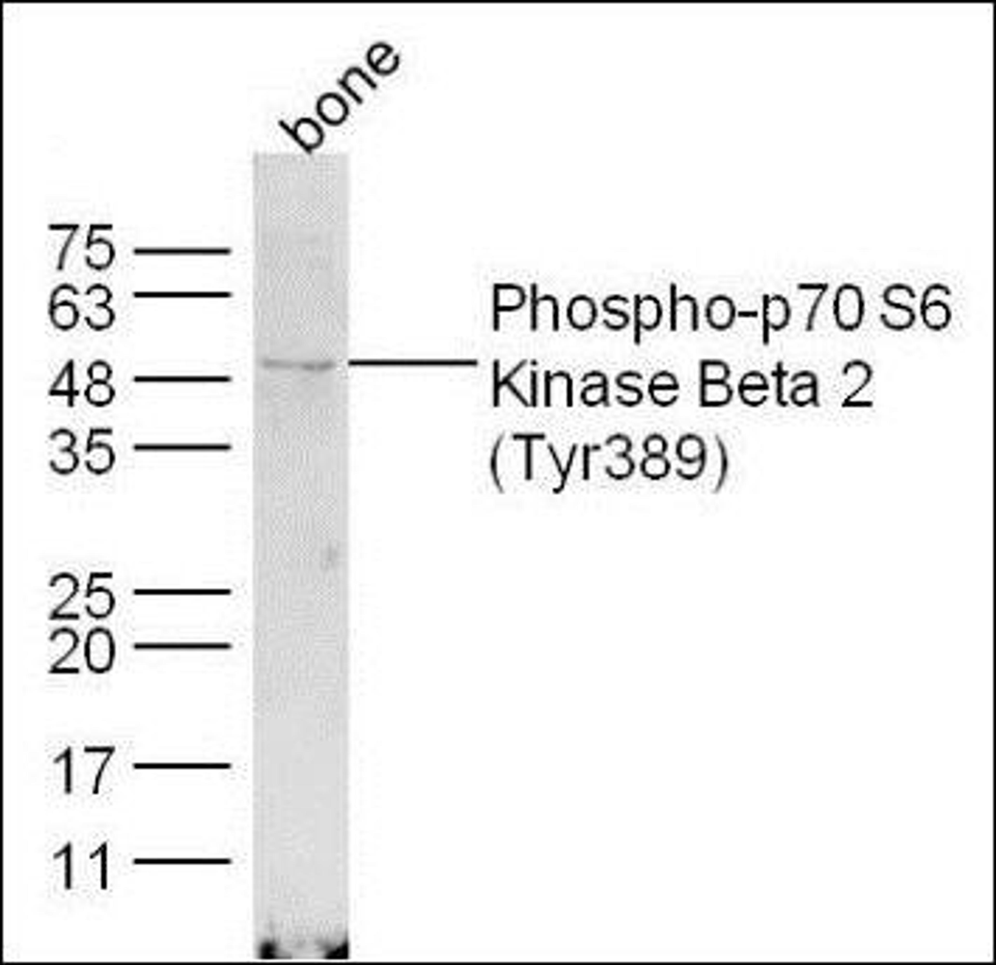 Western blot analysis of extracts from Bone tissue using Phospho-p70S6 Kinase Beta(Tyr389) antibody. 